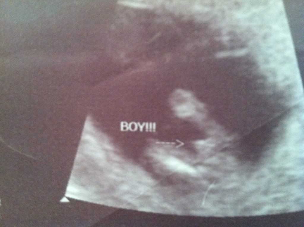 Anyone have a "potty shot" guess of boy around 1213 weeks and have it turn out wrong? BabyCenter