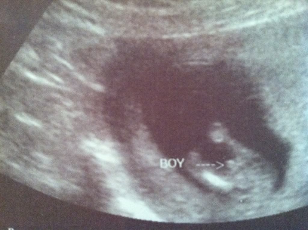 Anyone have a "potty shot" guess of boy around 1213 weeks and have it turn out wrong? BabyCenter