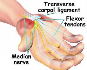 carpal tunnel master reviews