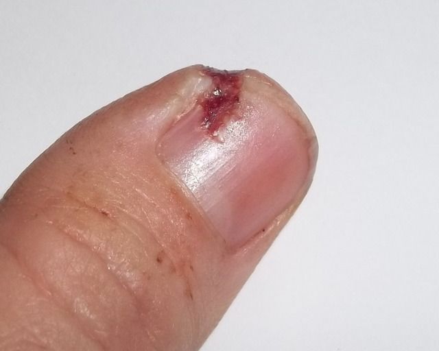 New tool!....Bad accident....and a WARNING!! - Goats