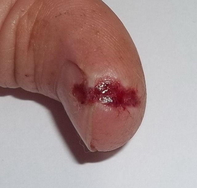 New tool!....Bad accident....and a WARNING!! - Goats